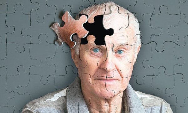 アルツハイマーの5つの警告サイン