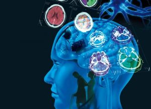 多発性硬化症の原因・症状・治療法