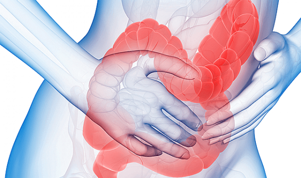 過敏性腸症候群