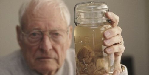 アインシュタインの脳を盗んだトーマス・ハーヴィー