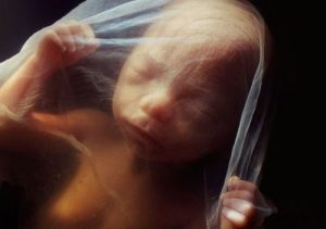 オットー・ランクと出生時のトラウマ