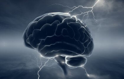 脳と雷