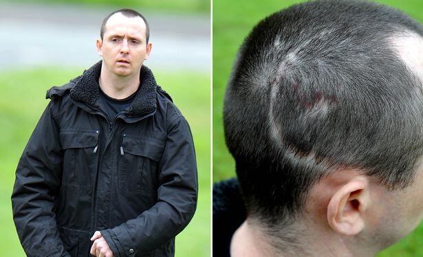 ポール・ピュー:病的笑いというケース