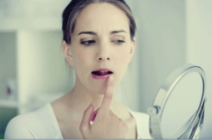 口唇ヘルペスとストレスとの関係性とは?