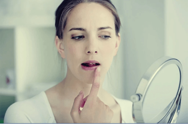 口唇ヘルペスとストレスとの関係性とは?